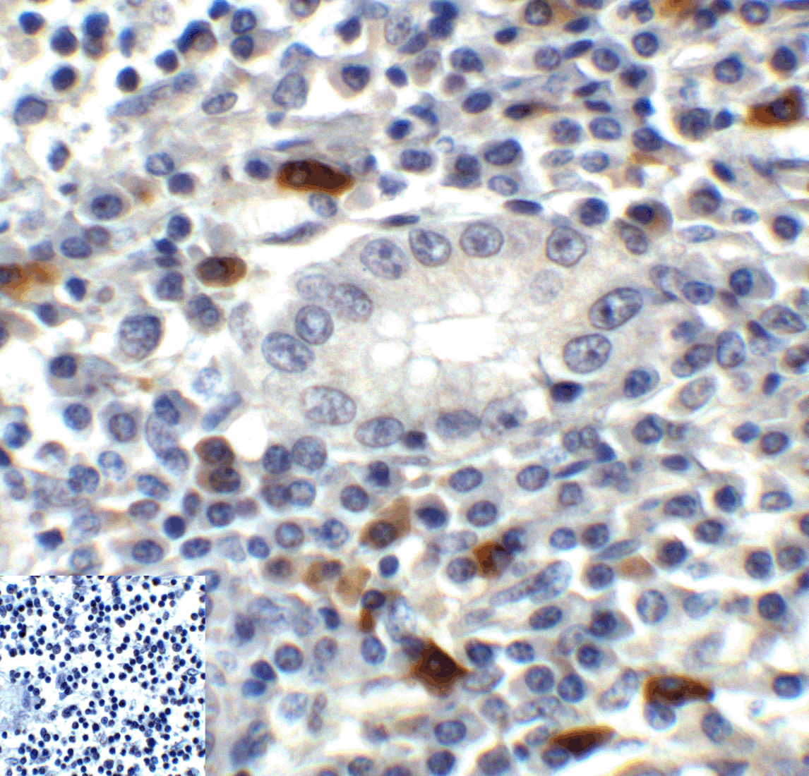 TIGIT Antibody [3B5]