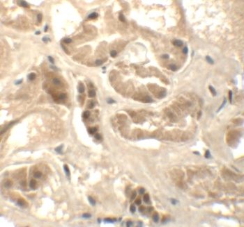 ATAD3B Antibody