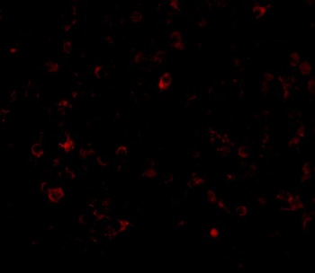 AIM Antibody