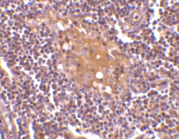 AIM Antibody
