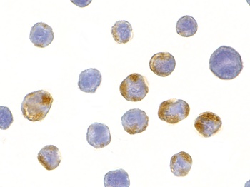 AES Antibody