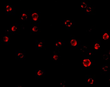 AES Antibody