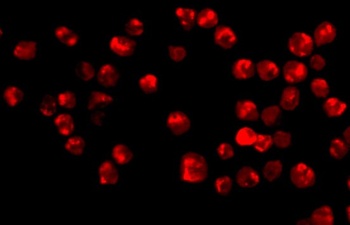 Acinus Antibody