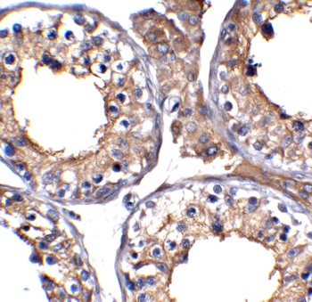 ACE2 Antibody (biotin)