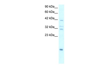 NFKBIA Antibody
