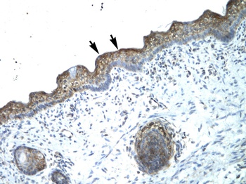 MYBL2 Antibody
