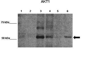 AKT1 Antibody
