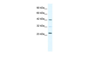 E2F1 Antibody