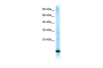 CDKN2B Antibody