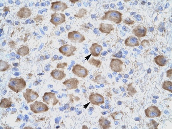 TNFRSF18 Antibody