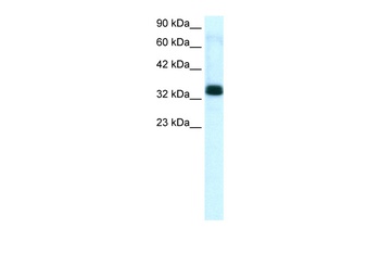 TIAL1 Antibody