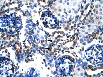 BAX Antibody