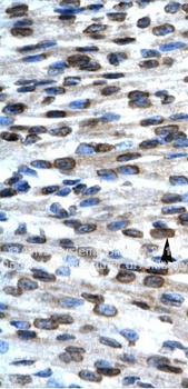 BAX Antibody