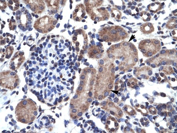 BCL2 Antibody