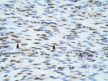 CARD12 Antibody