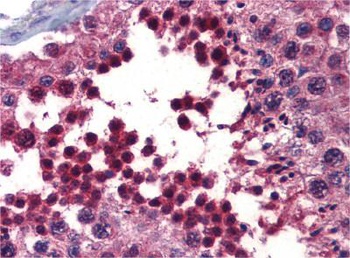 BMPER Antibody