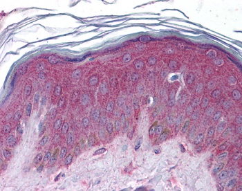 APC2 Antibody