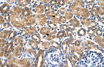 STK3 Antibody