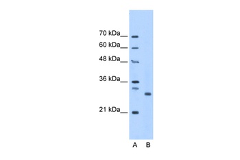PSMC3IP Antibody