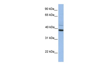 FKBP8 Antibody