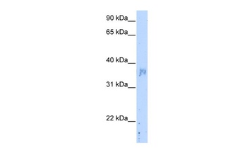 NOV Antibody