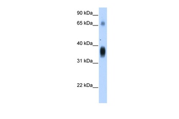 NOV Antibody