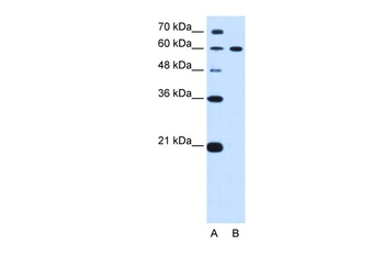 DTX2 Antibody