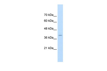 FKBP6 Antibody