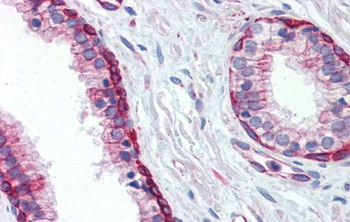 UBE2L3 Antibody