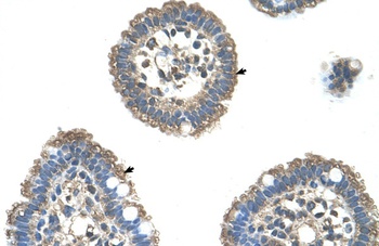 UBE2L3 Antibody