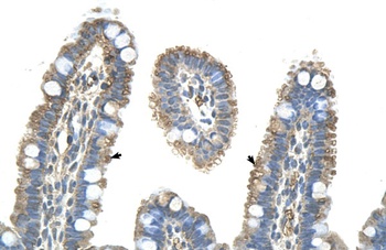 PANX1 Antibody