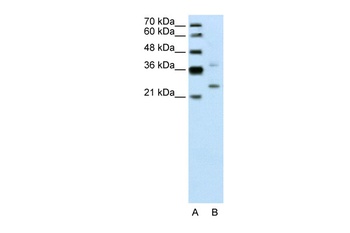 DCUN1D1 Antibody