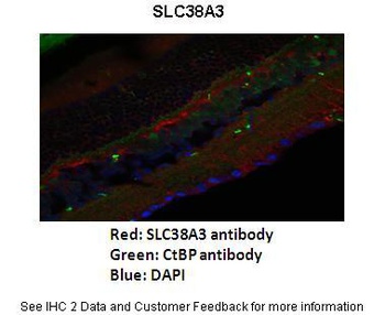 SLC38A3 Antibody