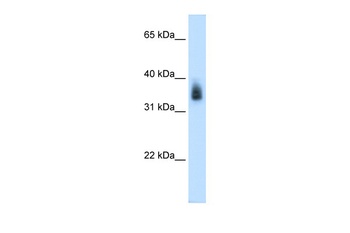 MAGEA8 Antibody