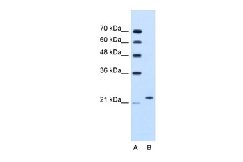 BAG2 Antibody