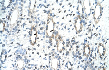 BAG2 Antibody