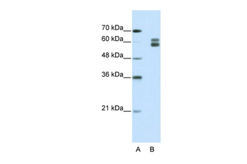 MSH2 Antibody