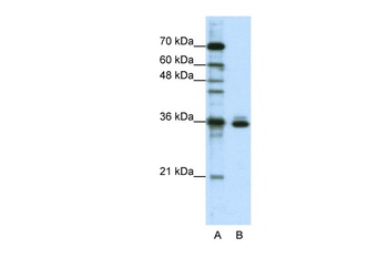 MSI2 Antibody