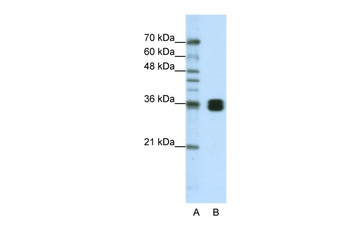 HNRPA0 Antibody
