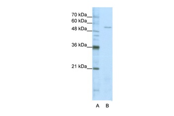 SARS Antibody