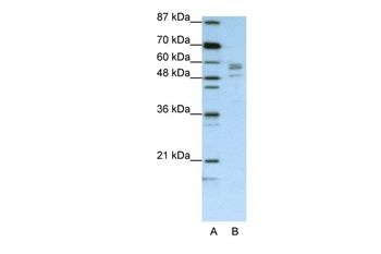 SARS Antibody