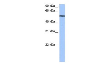 YARS Antibody