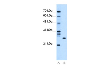 RBPMS Antibody