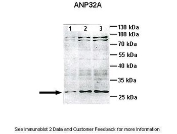 ANP32A Antibody
