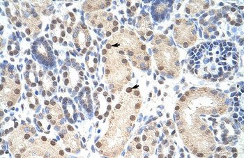ANP32A Antibody
