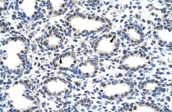 SMARCD2 Antibody