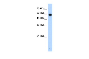 SMARCD2 Antibody