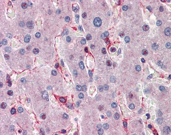 SIAH1 Antibody
