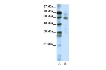 FOXO1A Antibody