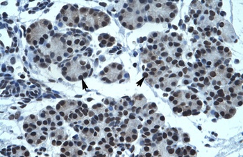 TPTE Antibody
